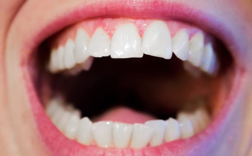 Aktualna technika stosowana w salonach stomatologii estetycznej może sprawić, że odzyskamy ładny uśmiech.